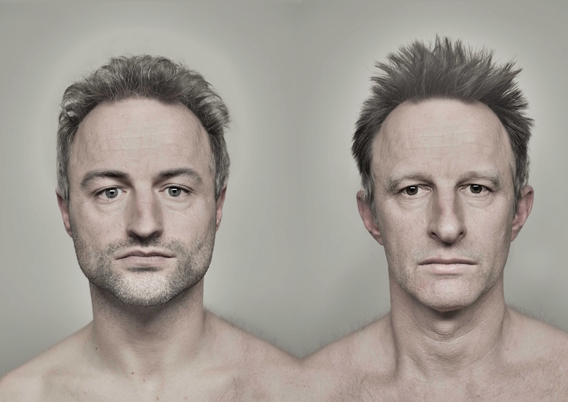 Editiepajot_ingezonden_seiz_beeld_het_lortcher_syndroom_c_tom_cornille